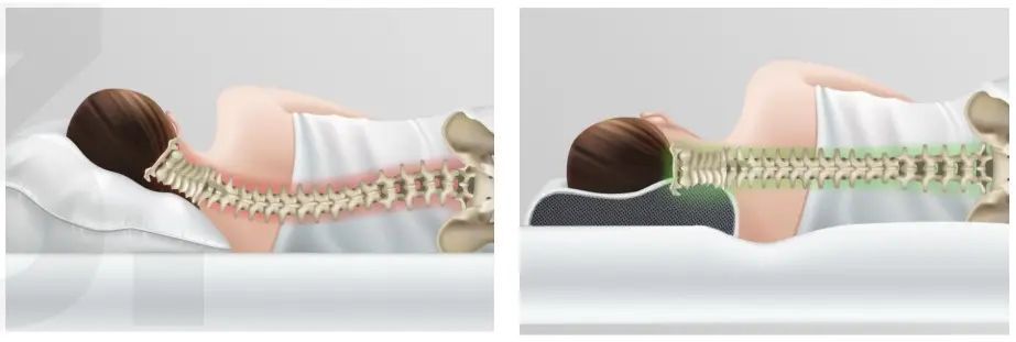 Derila Pillow Vs Regular Pillow